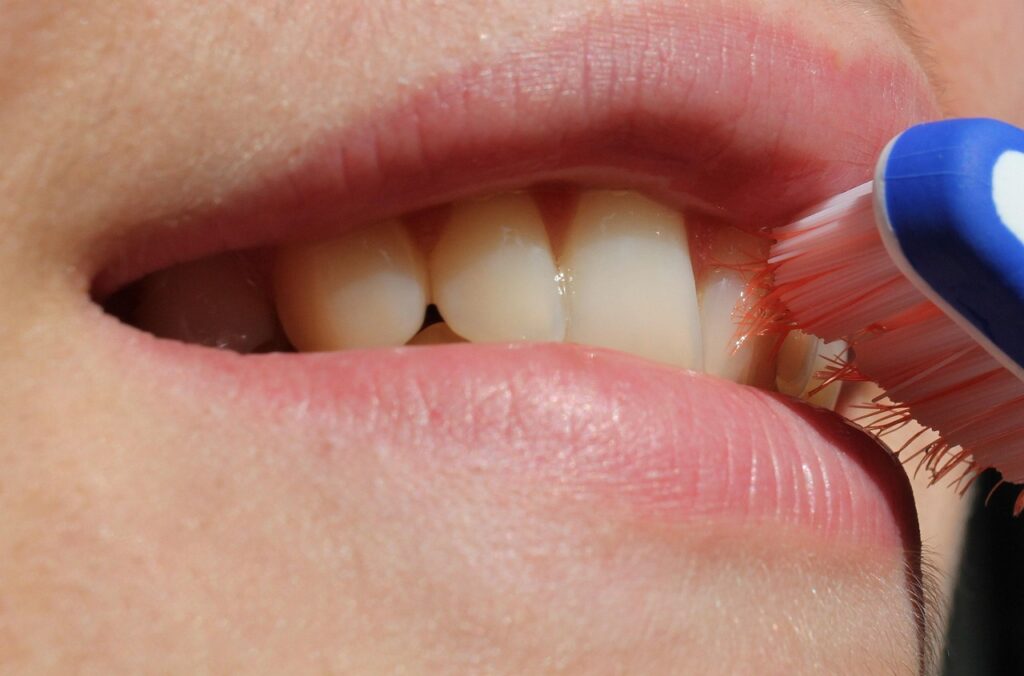 Limpieza dental Utebo